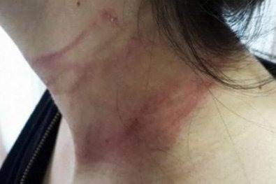 Um homem agrediu a mulher com tapas no rosto, enforcou-a e a derrubou no chão em Campo Grande