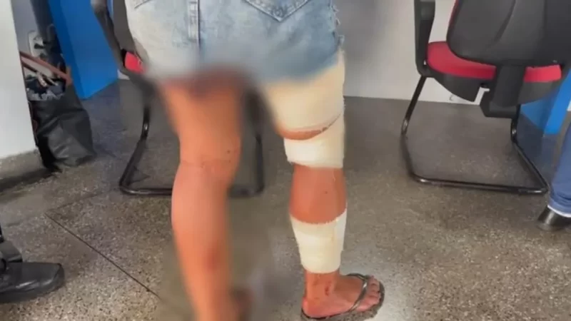 Na noite de terça-feira (22), uma mulher de 30 anos foi esfaqueada pela cunhada, de 22 anos, após uma discussão no bairro Danúbio Azul, em Campo Grande