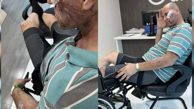 Ciclista é atropelado em Terenos e enfrenta demora de quase 2h por atendimento em hospital superlotado