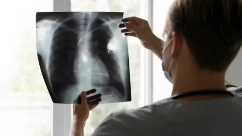 Vacina inédita contra câncer de pulmão iniciará testes em humanos em 2026