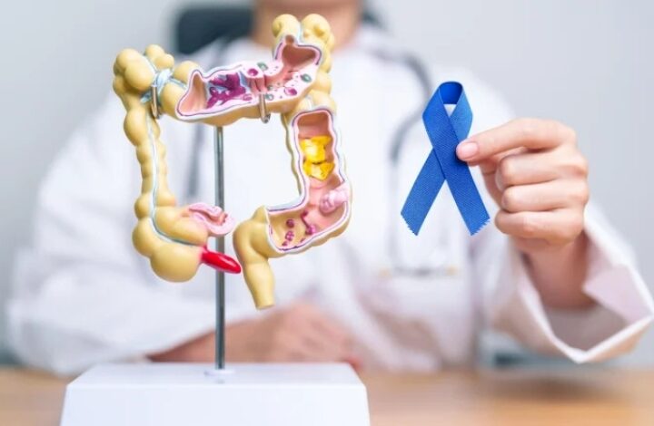 Mortes por câncer colorretal podem crescer até 181% no Brasil