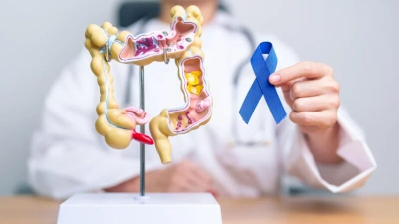 Mortes por câncer colorretal podem crescer até 181% no Brasil