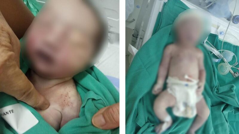 Bebê morre após parto com suspeita de negligência em MS; caso será investigado