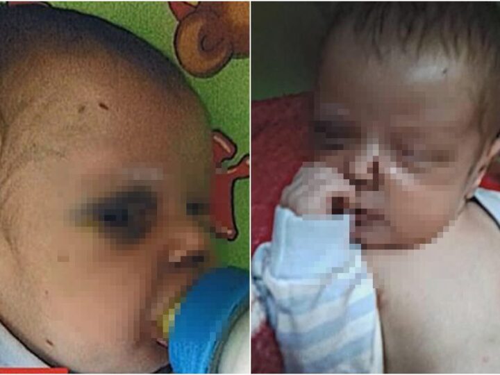 Mulher é presa após bebê dar entrada com sinais de violência em Campo Grande