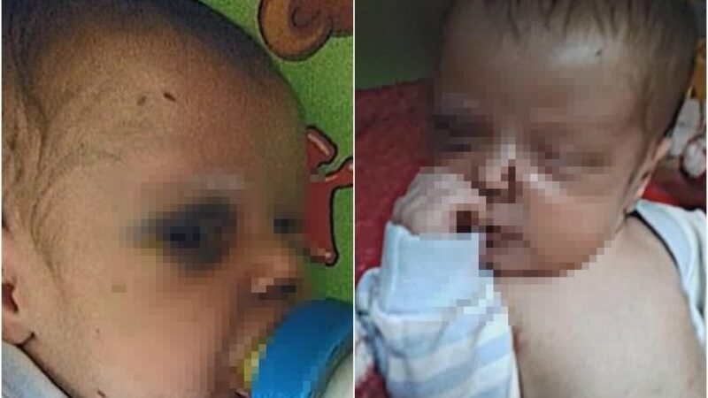 Mulher é presa após bebê dar entrada com sinais de violência em Campo Grande