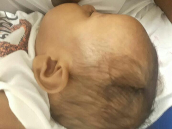 Bebê de 7 meses é internada após cair durante brincadeira do pai