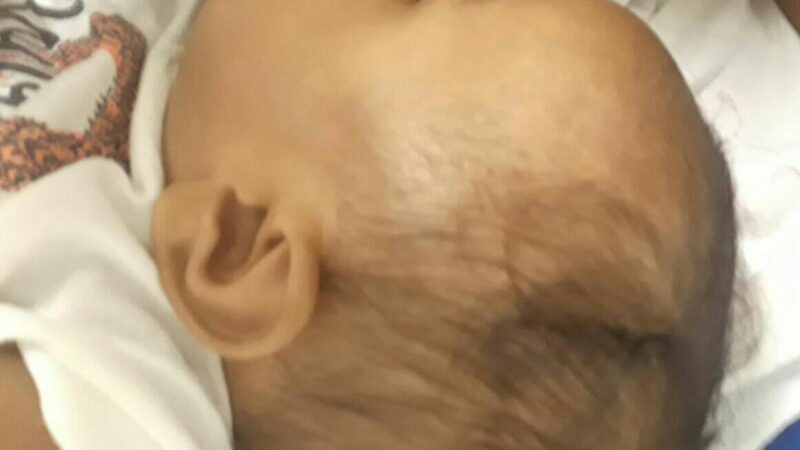 Bebê de 7 meses é internada após cair durante brincadeira do pai