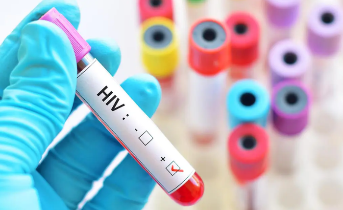 Dois novos casos de possível cura do HIV são anunciados durante conferência internacional no Rio