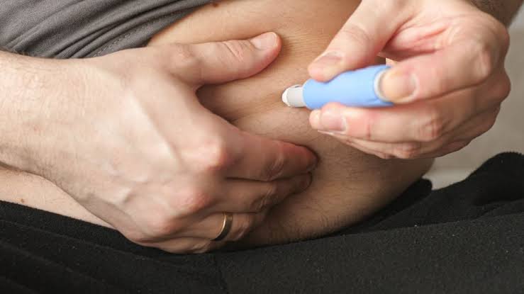 SUS avalia inclusão de novos medicamentos para tratamento da obesidade